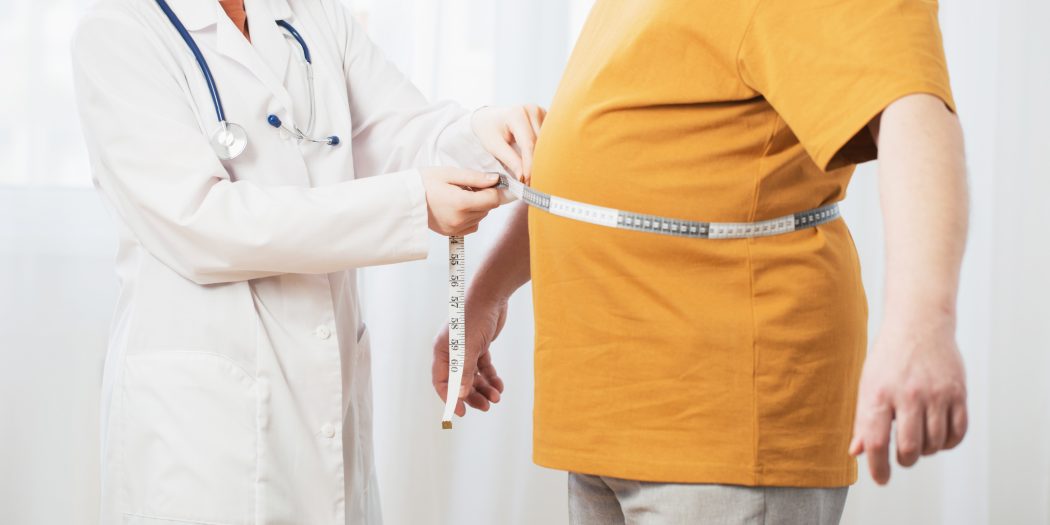 Chirurgia bariatryczna - pani doktor mierząca obwód w pasie otyłego mężczyzny