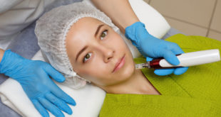 Mezoterapia mikroigłowa