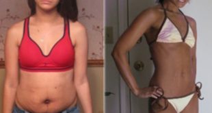 Przed i po odchudzaniu